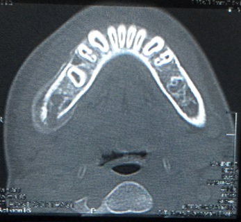 Axial CT Image
